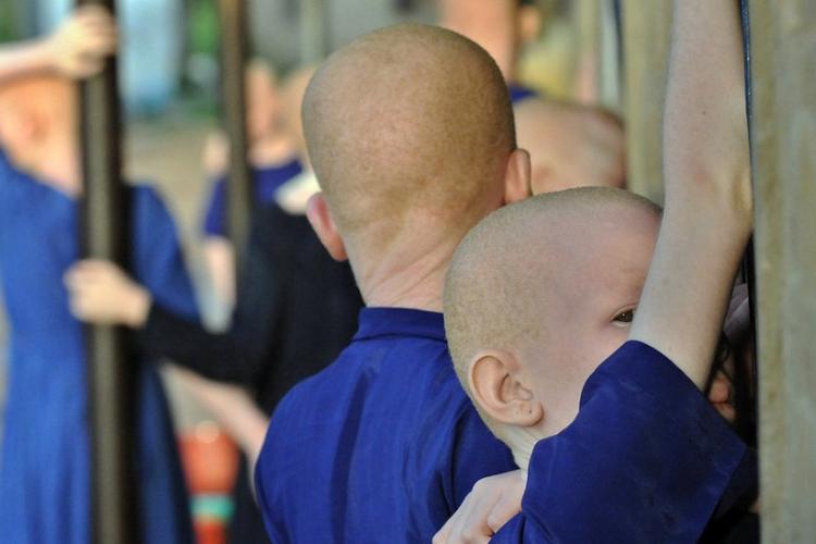 Justice for yosefe muyaya, a murdered boy with albinism